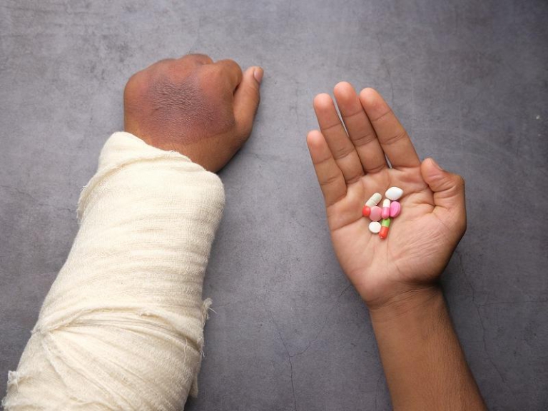 Here is a brief explanation as to what the Work Injury Compensation Act or WICA covers. It applies to all employees less a few exceptions.